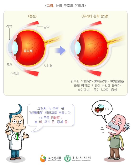 비전아이 이미지
