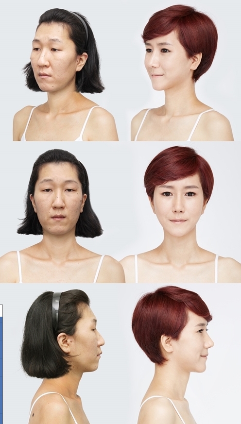 렛미인 이미지