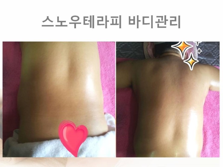 핫테라피 이미지