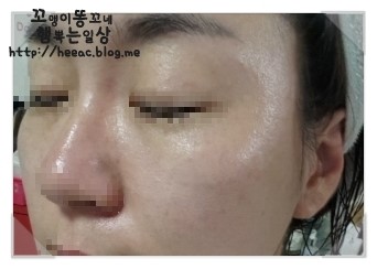 공주 피부관리실 이미지