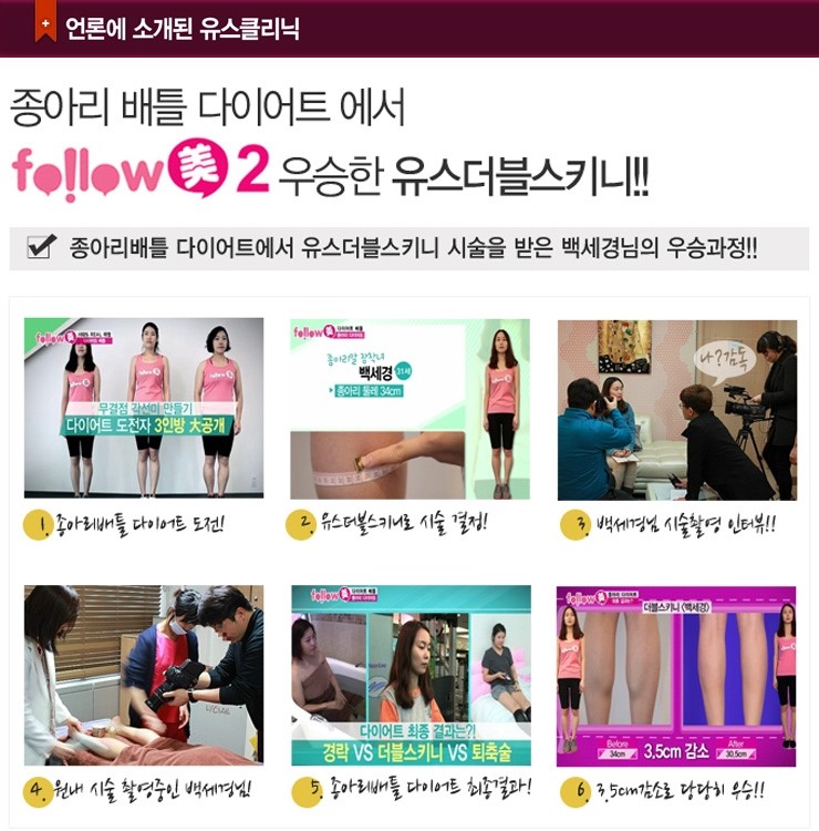 미스키니 이미지