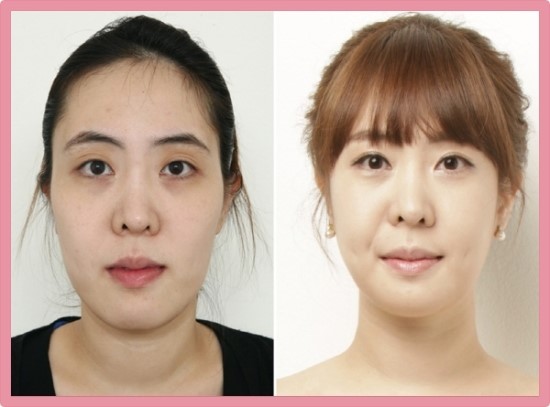 우리모바일 이미지