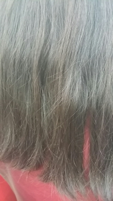 탑헤어라인 이미지