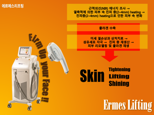 엔아이알 이미지