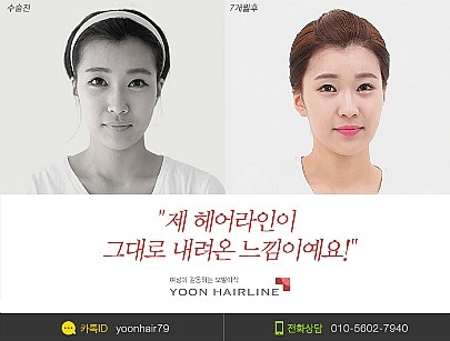 라인헤어 이미지
