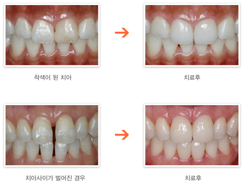 연세예스치과 이미지
