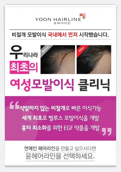 탑헤어라인 이미지