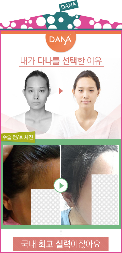 알헤어 이미지
