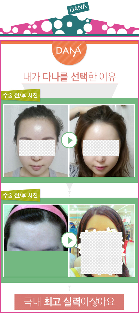 알헤어 이미지