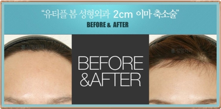 헤어체크 이미지