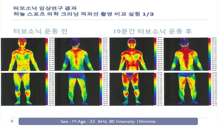 터보소닉 이미지