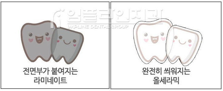 임플라인치과 이미지
