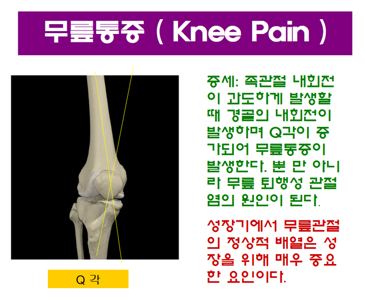 알즈너목포 이미지