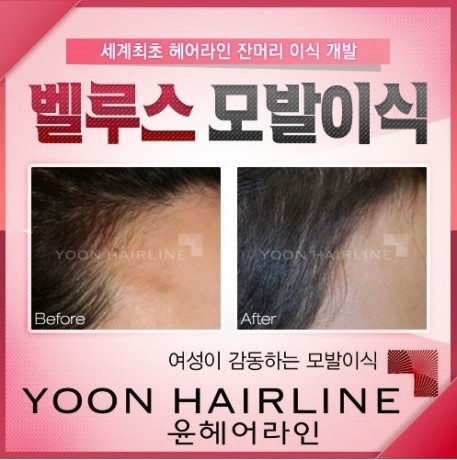 라인H 이미지
