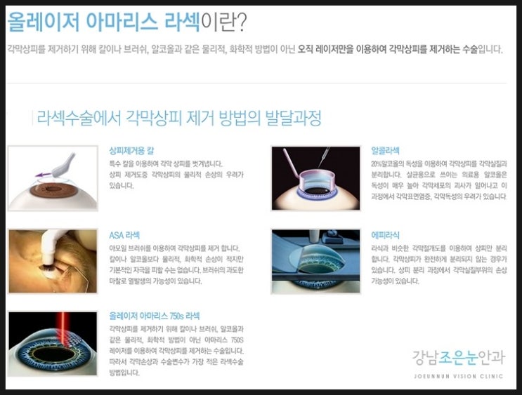 조은안과의원 이미지