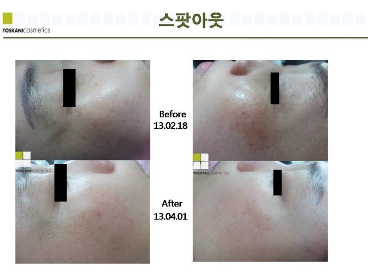 더피부샵 이미지