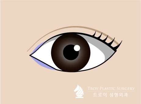 트로이성형외과 이미지