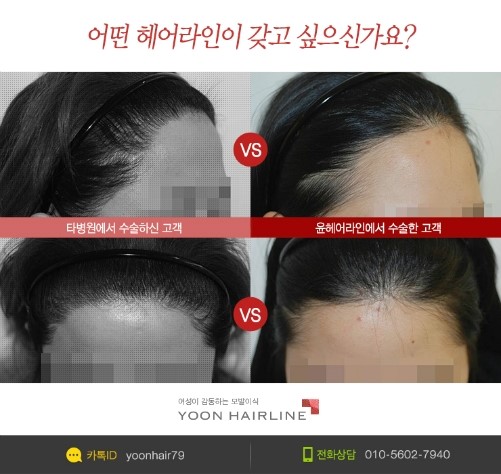 라인헤어 이미지