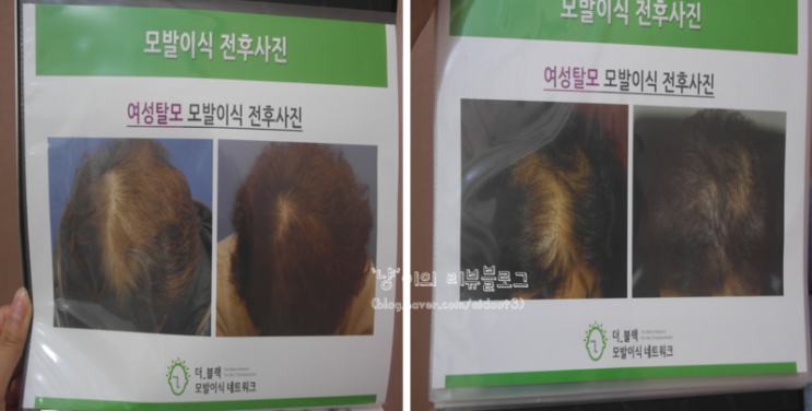 더블랙성형외과의원 이미지