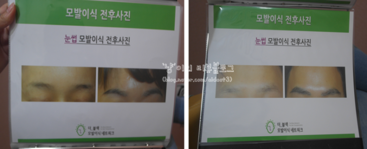 더블랙성형외과의원 이미지