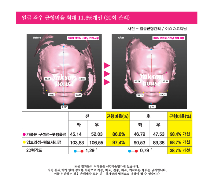 명가테라피 이미지