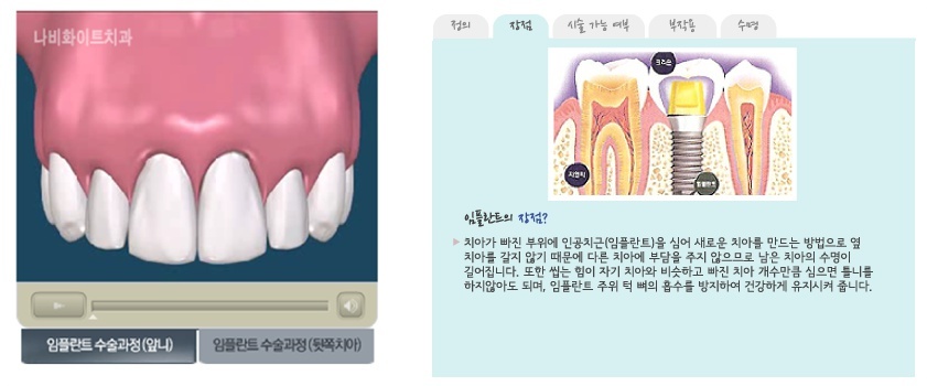 화이트치과 이미지