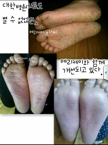케이커스트 이미지