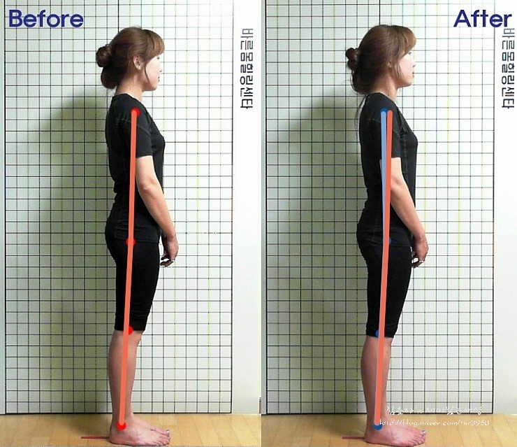 바른체형힐링센터 이미지