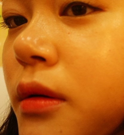 세라테라피 이미지