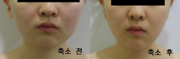 예인에스테틱 이미지