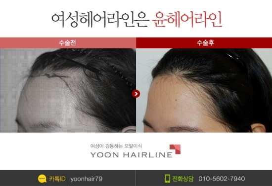 라인헤어 이미지