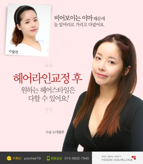 라인헤어 이미지