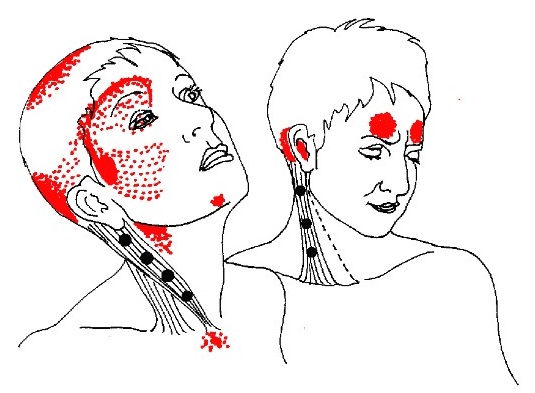 머슬테라피 이미지