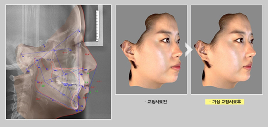바로이치과 이미지