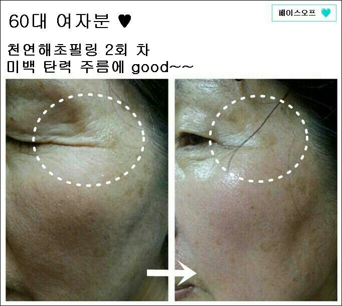 서울참피부과의원 이미지