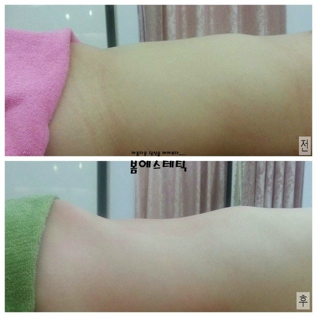 금불테라피 이미지