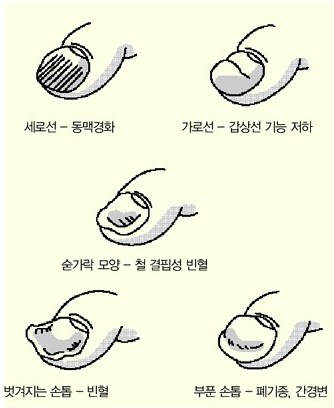 예쁜손톱 이미지