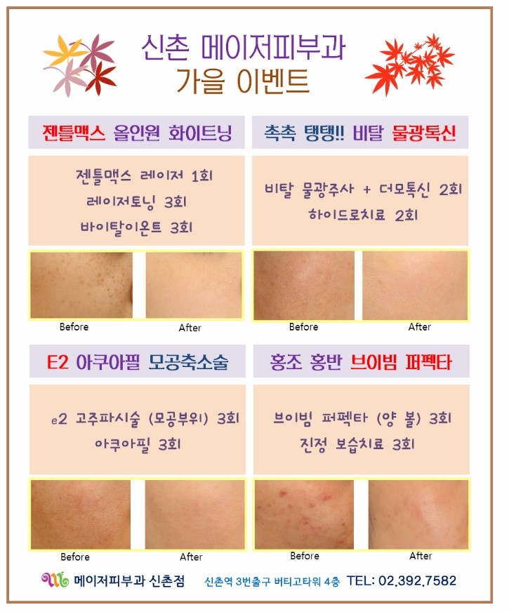 필이벤트 이미지