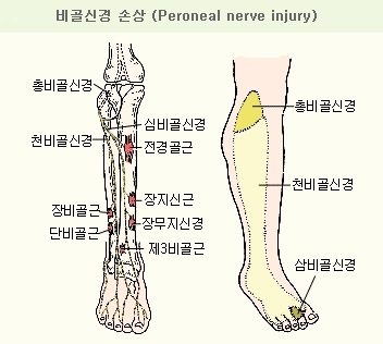 보험 & 손해사정 : 네이버 블로그 보험 & 손해사정 : 네이버 블로그