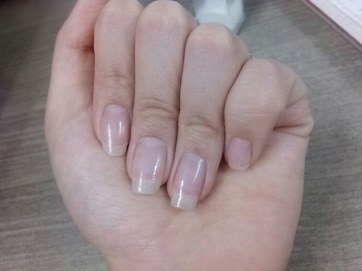 제로네일 이미지