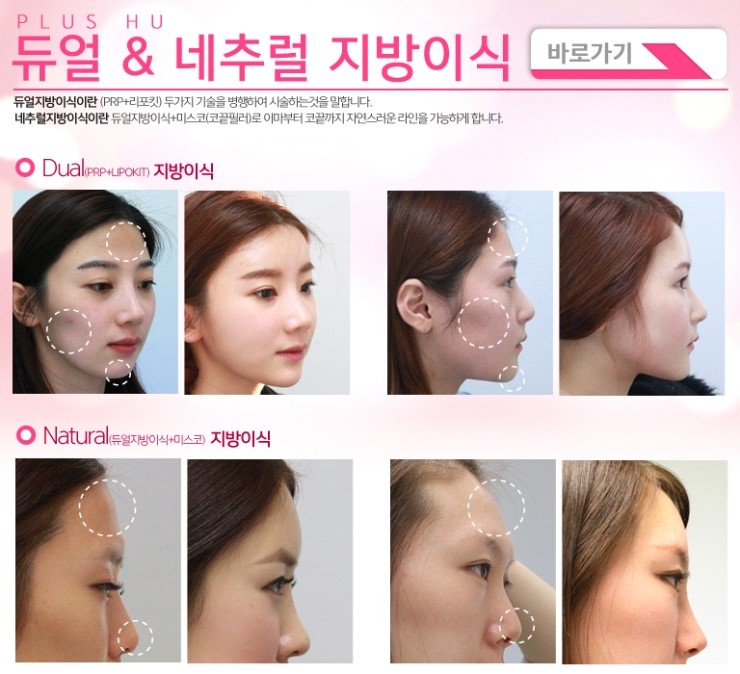 다운전자 이미지