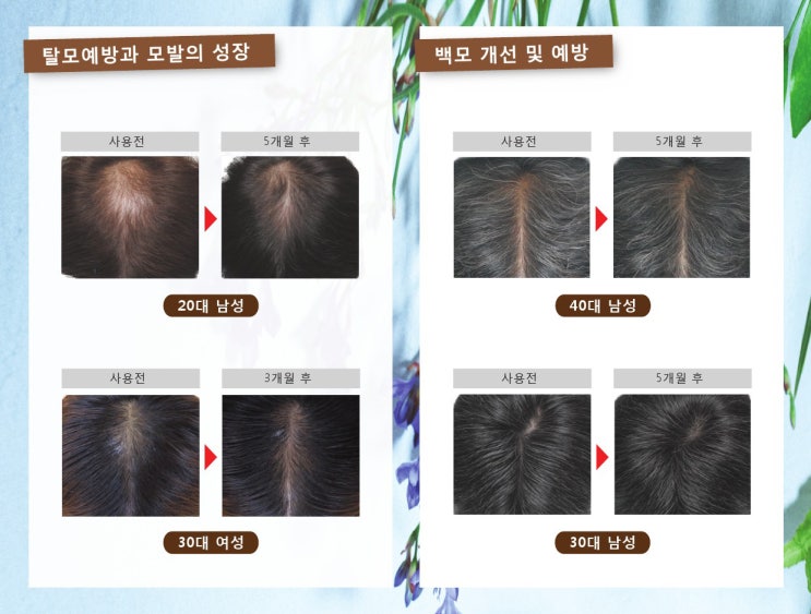 리바이브헤어 이미지