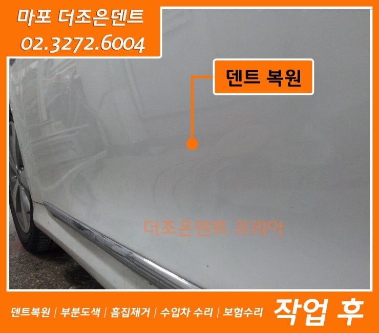 더조은덴트 이미지