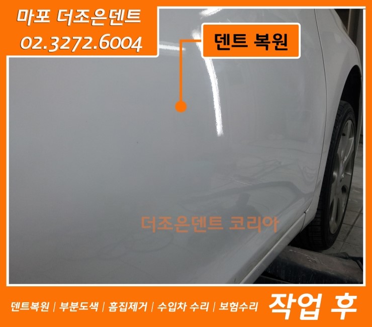 더조은덴트 이미지