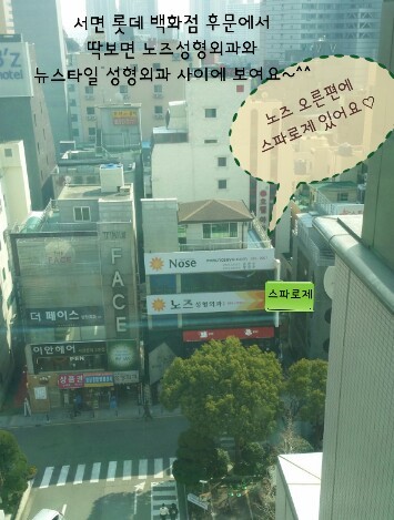 스파로제 이미지