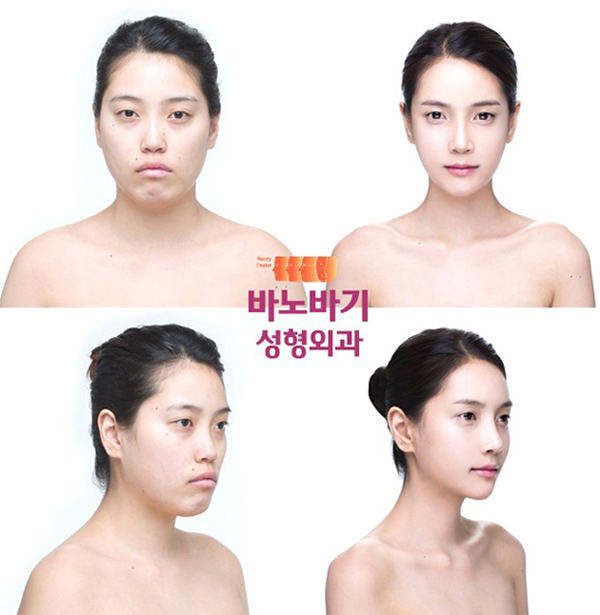 바노바기 성형외과 이미지