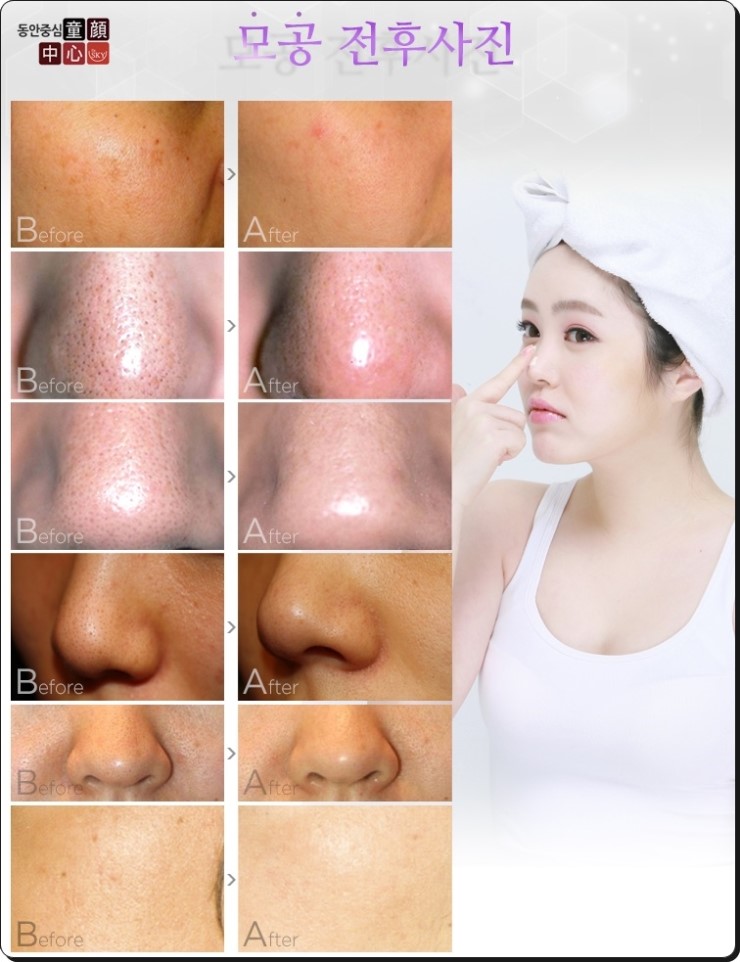 공피부과 이미지