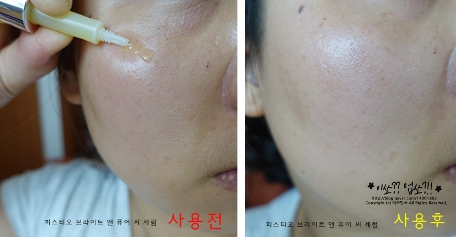 피스티오 이미지
