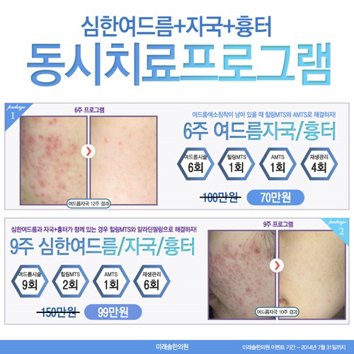 드아본 이미지