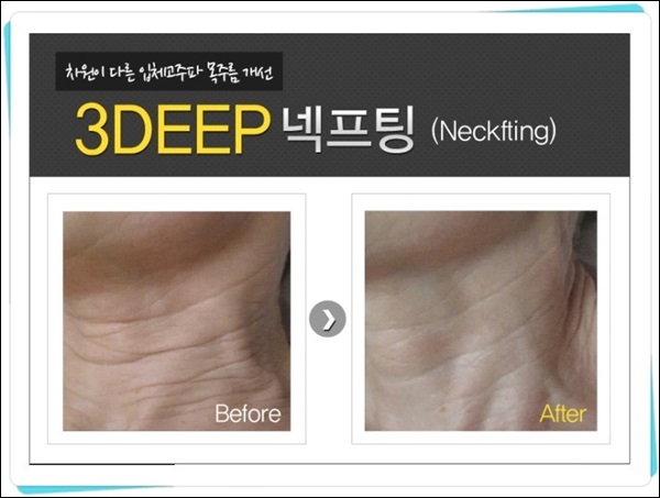 빛고을미의원 이미지